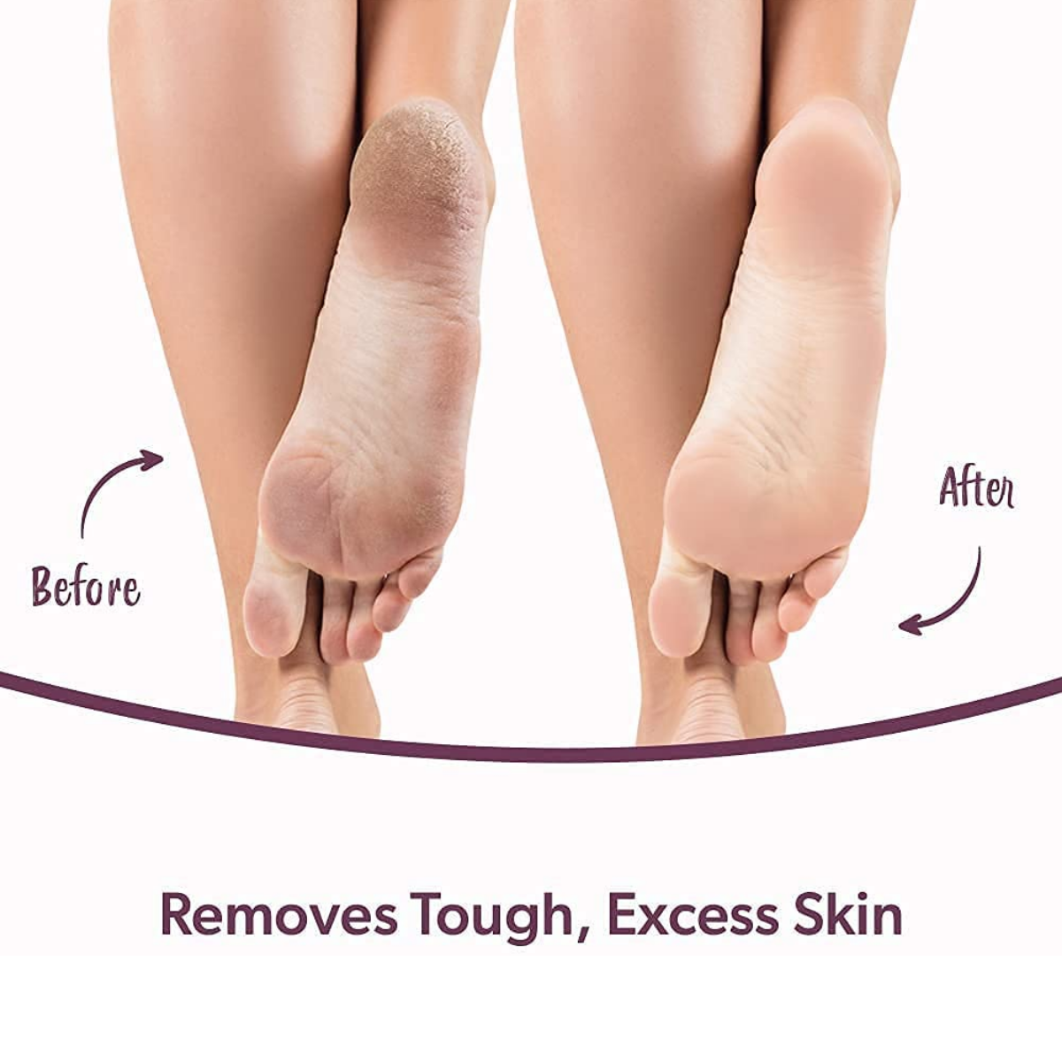Foot Revive 2 in 1 Electric Callus Remover